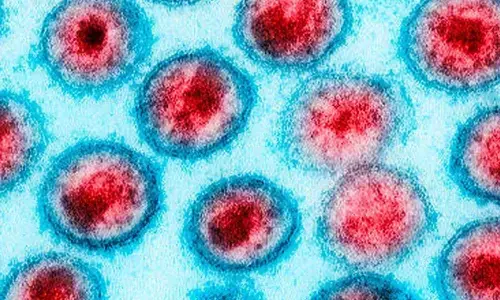 Woman From America Totally Recovered From HIV