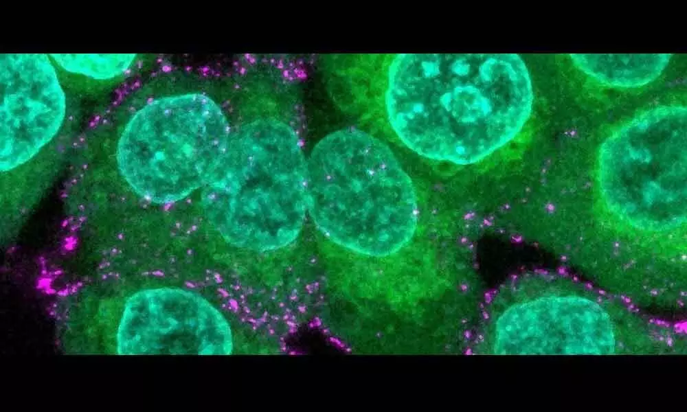 Human cells (green) with synthetic virions (magenta).