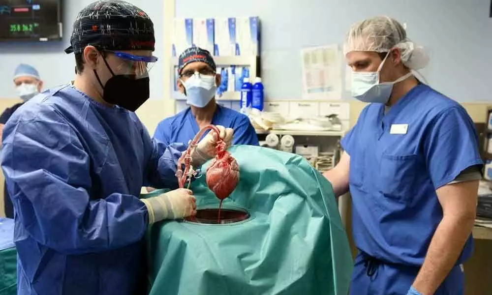 Recipient Of First Successful Pigs Heart Transplant Passed Away