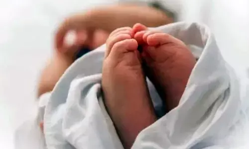 For representational purpose