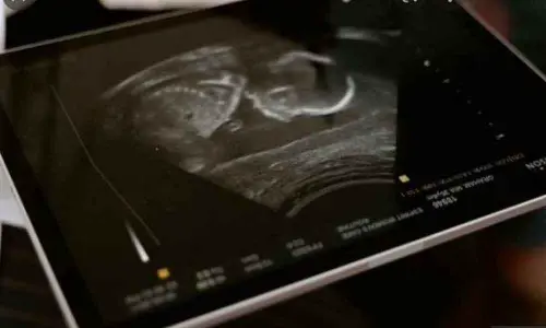 IIT Madras researchers develop new technique to provide high resolution ultrasound images