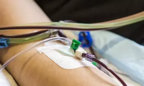 For representational purpose