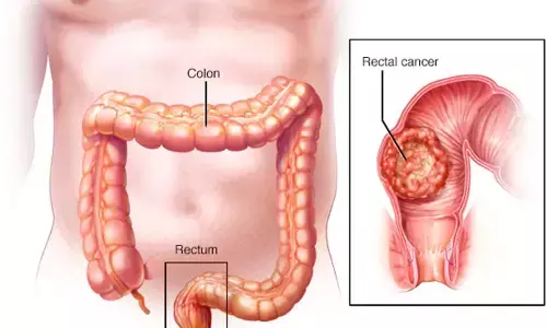 Doctors heal 83-yr-old ailing with rectal cancer