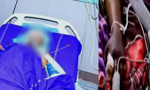 Srinivas, a rat nibble victim at Warangal MGMH passes away