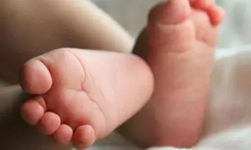 Representational Image