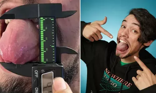 Man From USA Achieved Guinness World Record For Massive Tongue