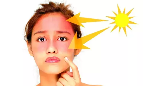 Avoid skin tan in Summer