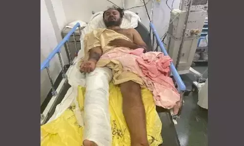 Bengaluru: Acid attacker tries to flee, police shoot him in the leg