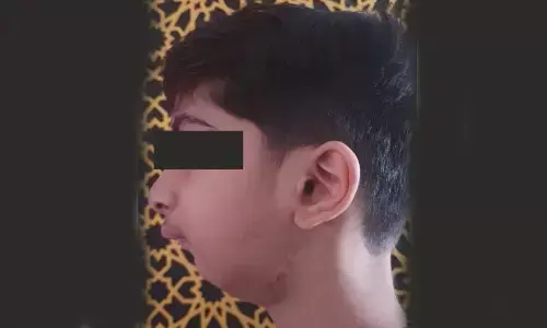 10-yr-old with dentofacial deformity treated successfully