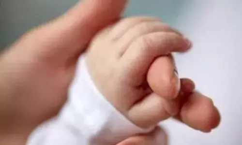 Representational Image