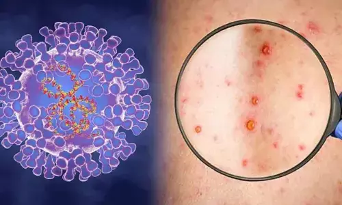 Representational Image