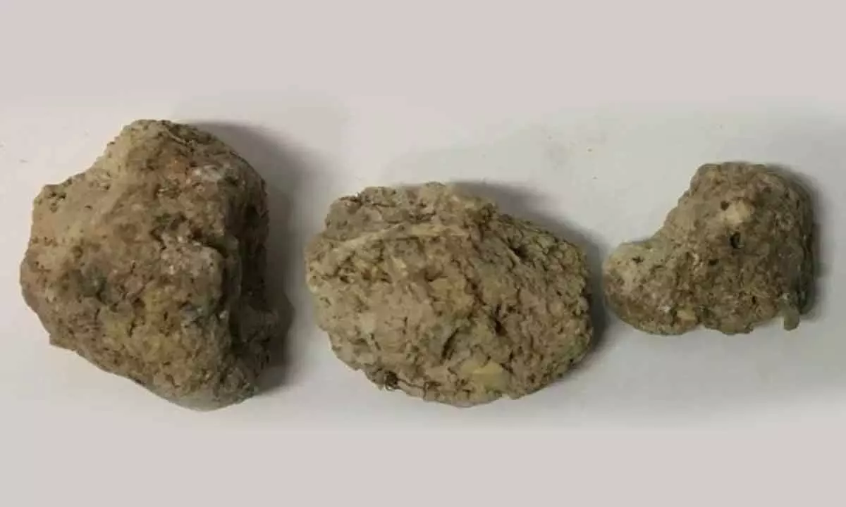 Preserved human feces from Durrington Walls. (Lisa-Marie Shillito)