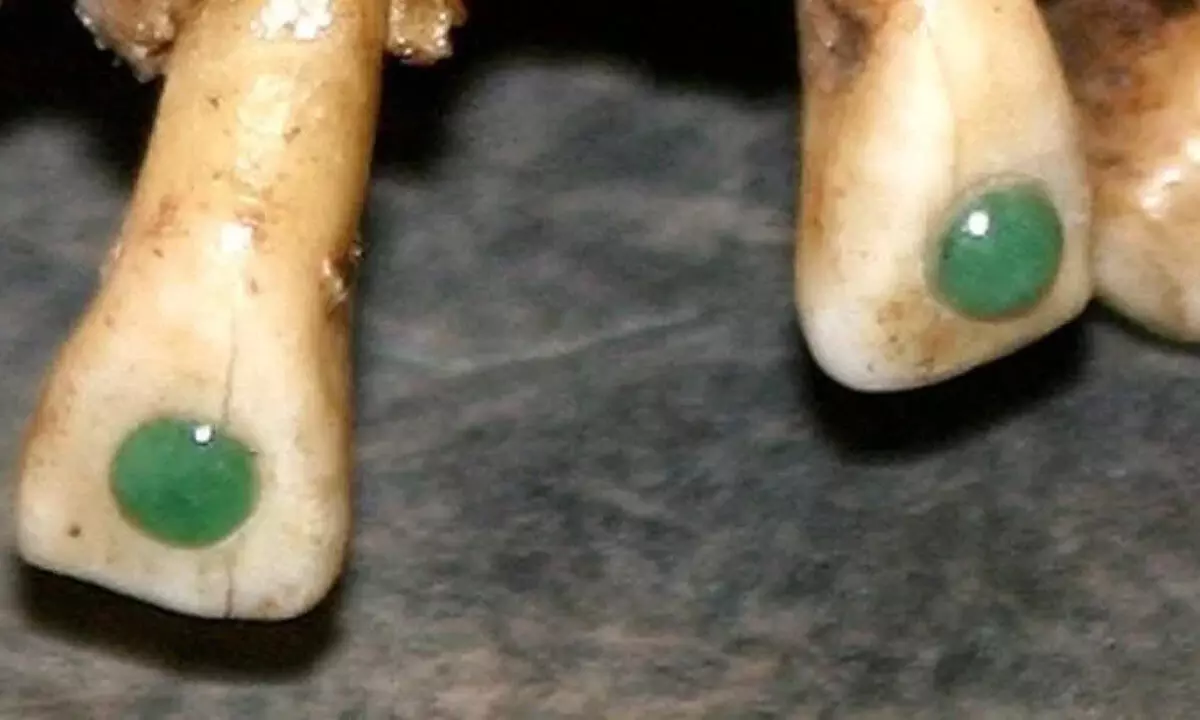 New Research Showed Jewels In Maya Teeth