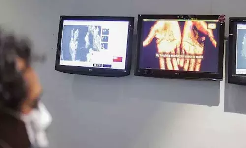 Monkeypox virus detected in Portugal less aggressive, researcher says