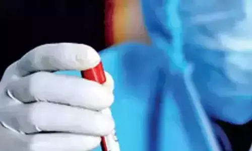 International Travellers With Symptoms Of Monkeypox To Be Isolated In Tamil Nadu