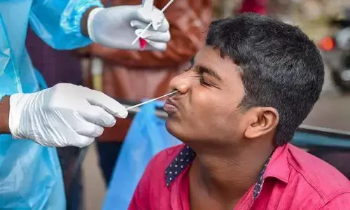 Representational image