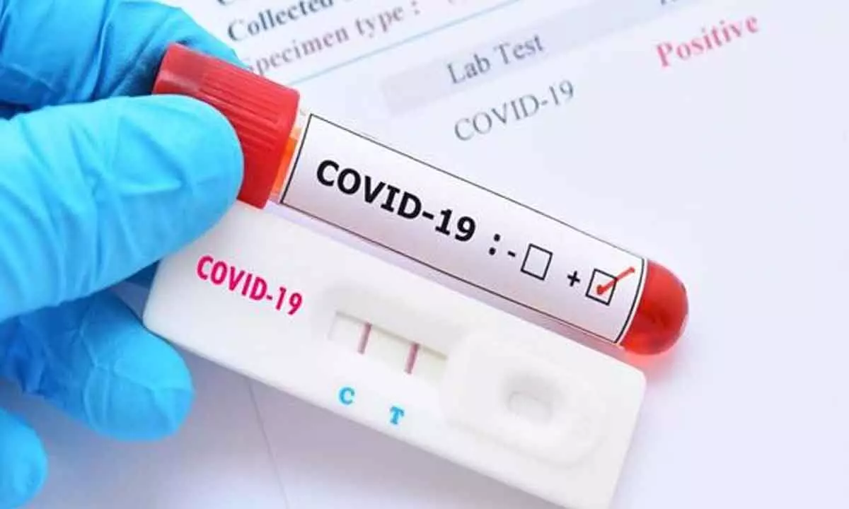 7,240 new Covid-19 cases recorded in the country