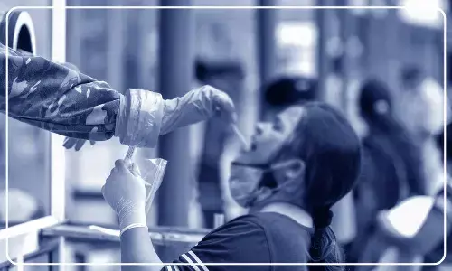 For representational purpose