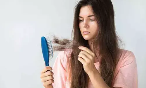 Predict your hair fall