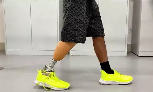Prosthetic leg for Indian conditions developed