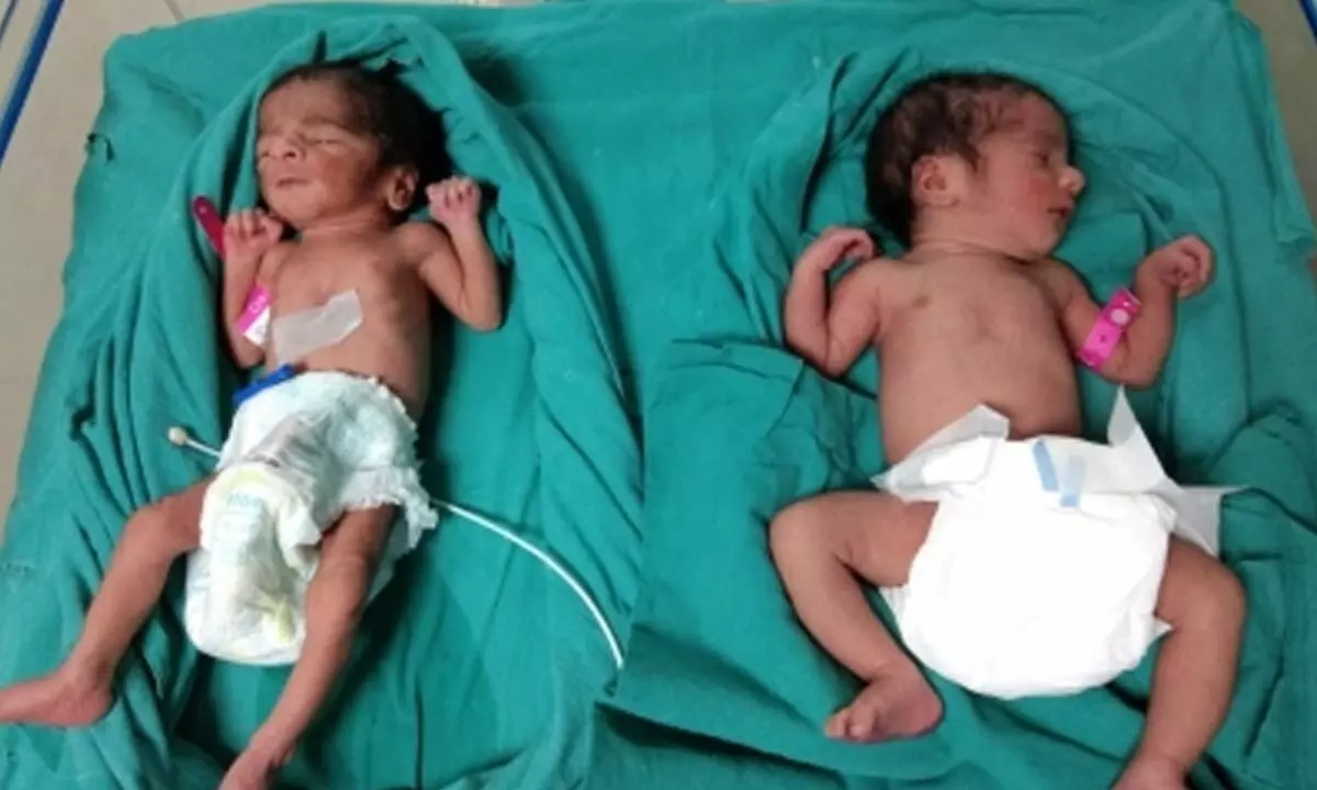 Mentally unstable woman abandons twins in Surat hospital