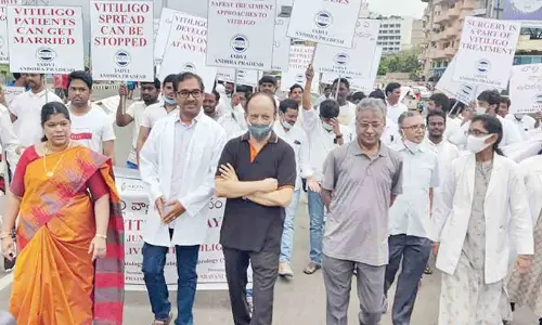 Mayor Golagani Hari Venkata Kumari dermatologists and specialists take part in a rally to mark ‘World Vitiligo Day’ organised by  NAADVL  in Visakhapatnam on Saturday