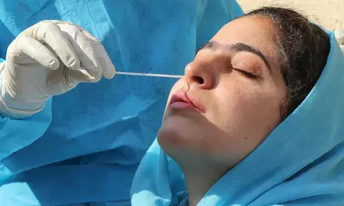 For representational purpose