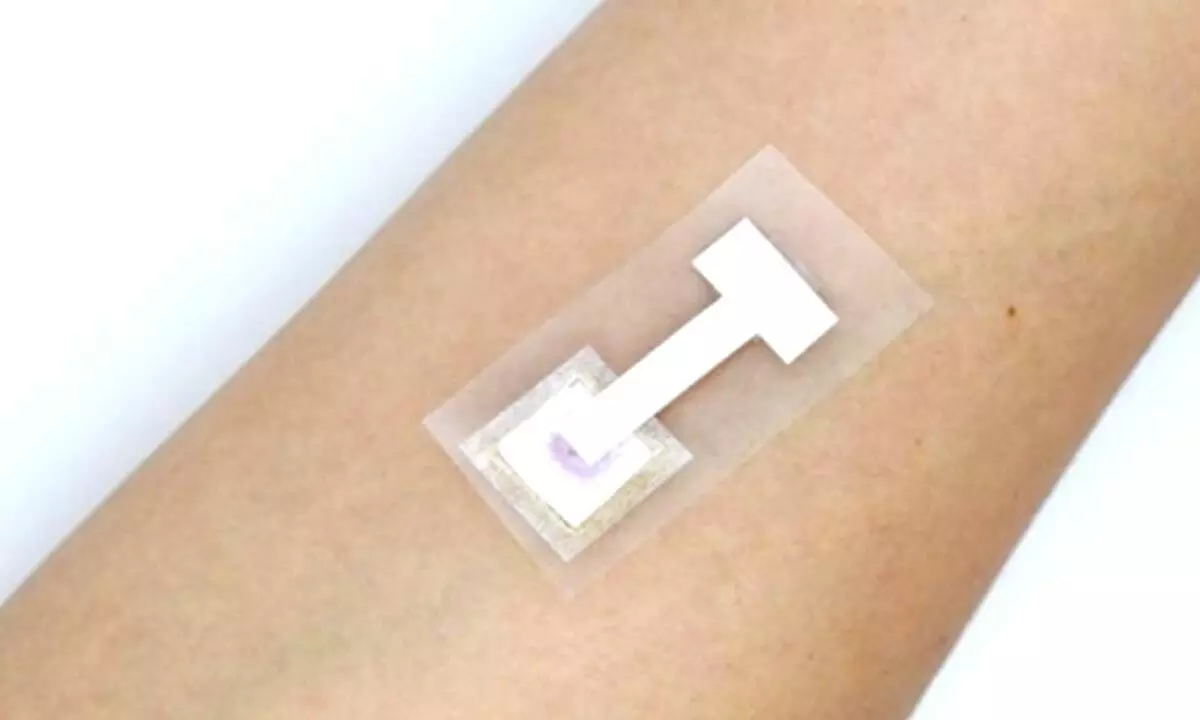 New patch test can detect Covid antibodies within 3 minutes
