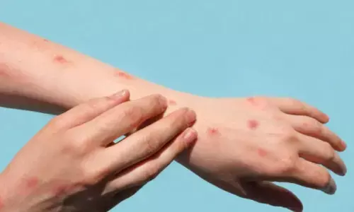 Representational image