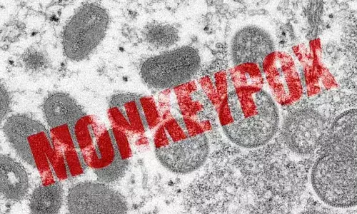 This 2003 electron microscope image made available by the U.S. Centers for Disease Control and Prevention shows mature, oval-shaped monkeypox virions.