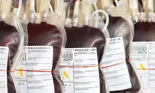 Representational picture