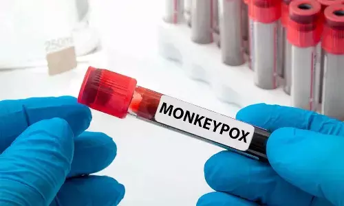 Canada confirms 604 cases of monkeypox
