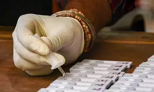 Representational image