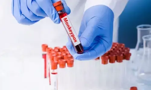Suspected case of monkeypox in UP