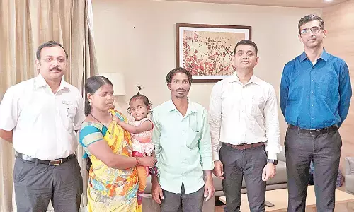 Girl with ‘Tessier facial cleft’ gets complete face reconstruction