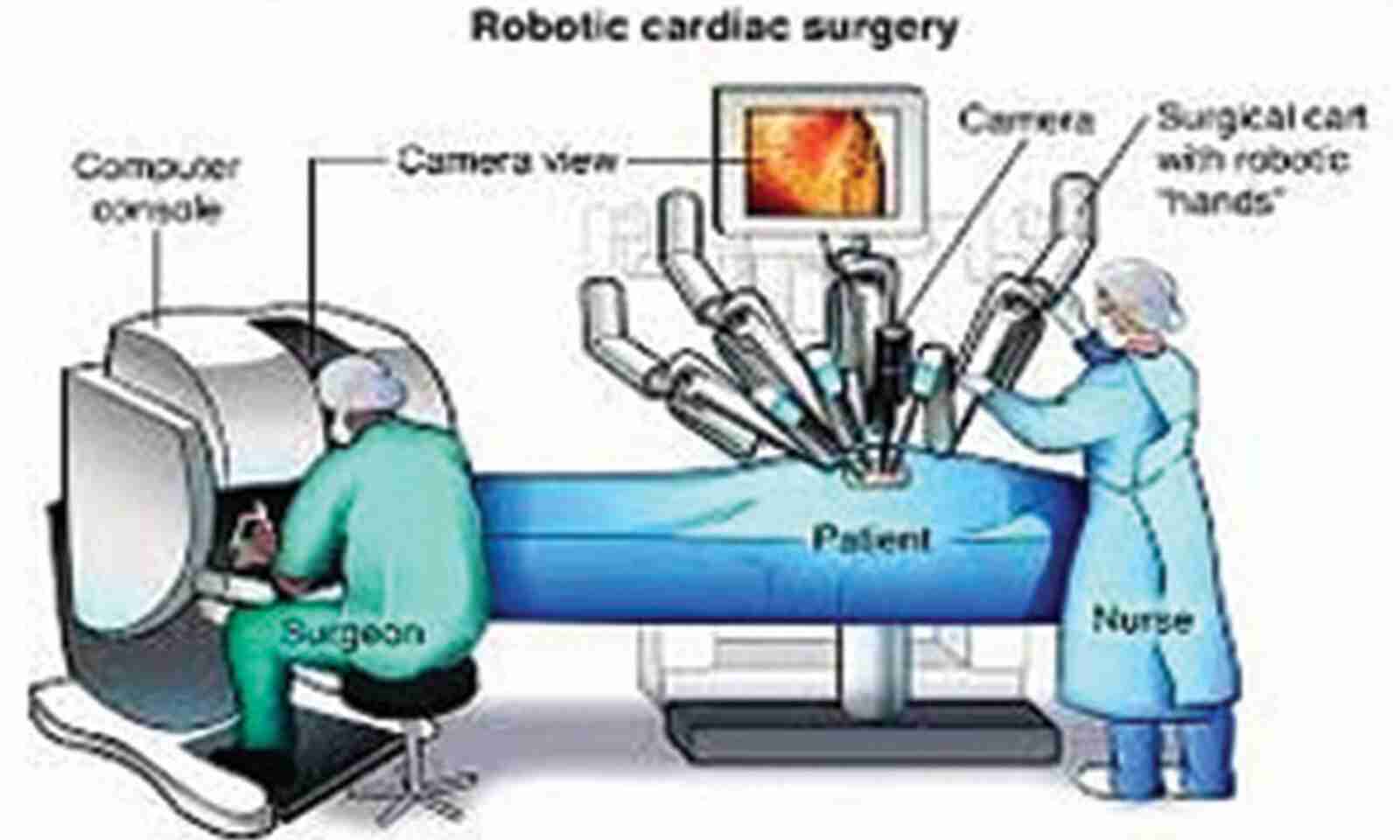 In a Apollo Hospitals conducts Robotic on