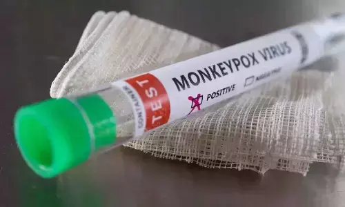 Philippines detects 1st monkeypox case