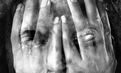 44-year-old man convicted for pouring acid on his wife