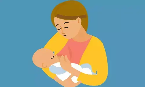 Representational image