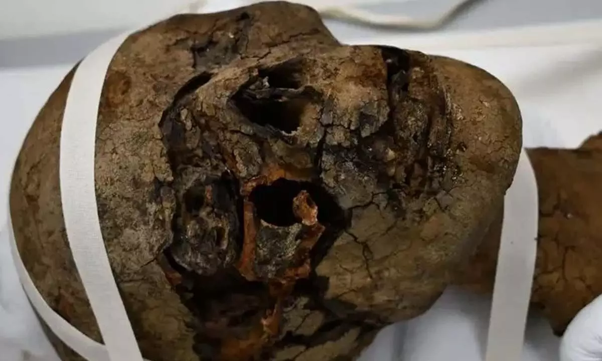 The 2,000-year-old ancient Egyptian mummy head. (Maidstone and Tunbridge Wells NHS Trust)