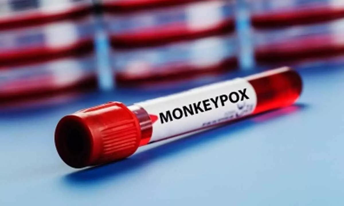 UK must take more action on monkeypox or it will become endemic