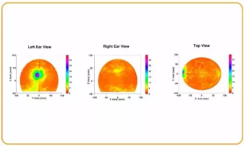 IIT-D Researchers Propose Non-invasive Diagnostic Tool for Epileptogenic Zone Detection