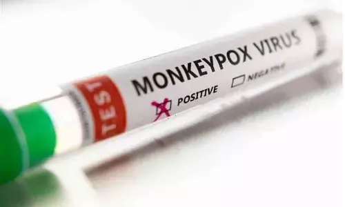 Germany confirms first monkeypox case in a child