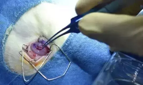 Indias first 3D bio-printed cornea developed in Hyd