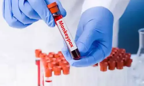 Monkeypox infections rise 20% to over 35K cases, 12 deaths: WHO