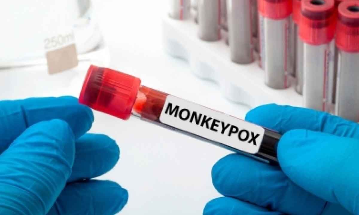 Canada confirms 1,444 monkeypox cases