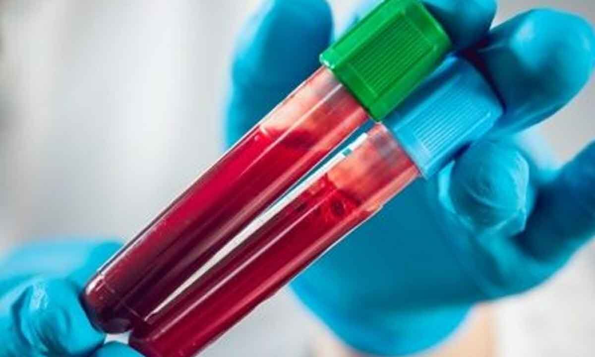 early-blood-tests-can-predict-death-for-traumatic-brain-injury-study