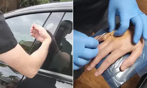 Tesla Owner Inserts A Little Chip Into His Hand