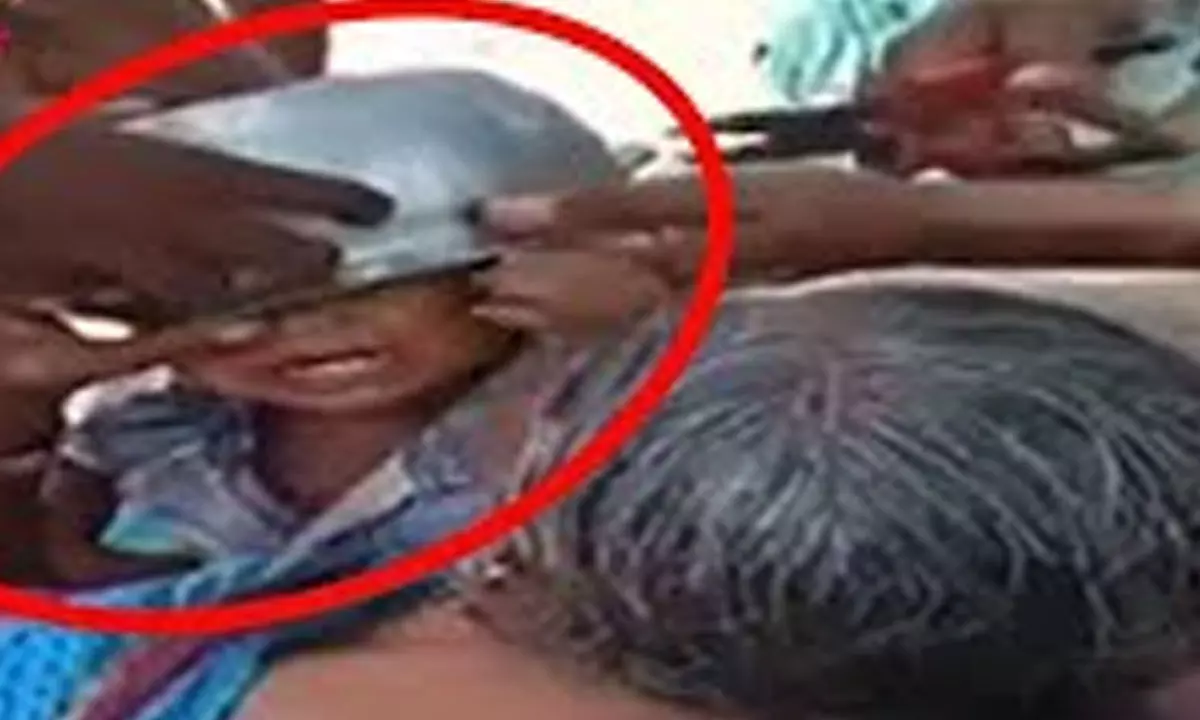 Child’s head gets stuck in cooking vessel in Wanaparthy