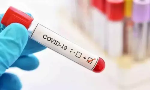 For representational purpose